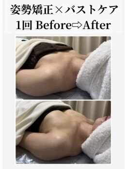 スターティス(STATICE)/バストケア