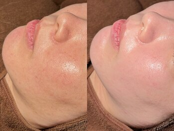 ルーナジェーナ(Luna llena)/池袋　エステ　ルーナジェーナ