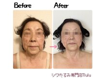 トルル(Tlulu)の雰囲気（【Before After】ハンドでここまで輪郭変わります。別人のよう！）