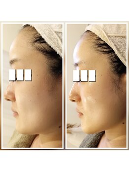 イーオ(io)/ブライダルのお客様