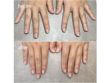 自分の爪がもっと好きになる♪お悩みご相談ください！