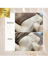 ロココ 町田店(Rococo)/鎖骨下からボリュームUP！