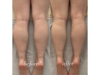 ケリービューティーサロン(kelly beauty salon)/脚のメンテナンス