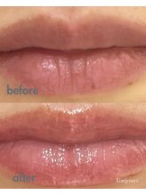 トゥジュール(Toujours)/リップエステ☆