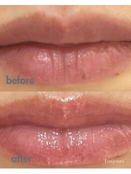 トゥジュール(Toujours)/リップエステ☆