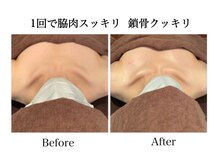 ナチュラーレ 天王寺店(Naturale)/痩身リンパマッサージ二の腕美脚