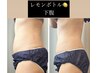 【1カ月以内のご予約で】脂肪撃退☆レモンボトルorレッドショットお身体1か所