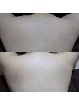 トラット エステアンドアイズ(tratto)/30代　お客様症例写真