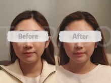 ティアラボ(TIARABO)/