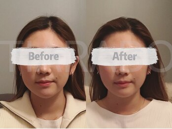 ティアラボ(TIARABO)/