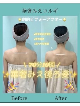 アコガレコガオ 鳥取店/コルギのビフォーアフター