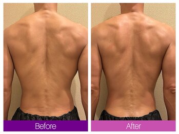 クレヴィア バイ サイバーエステ(CREBIA)/カット出しでさらに魅力的に!