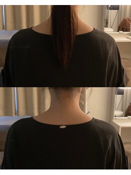 ロアー 赤坂店(RAWR)/肩の張り改善!