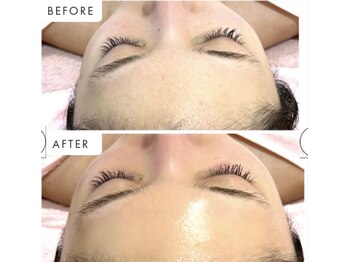 萬裡(マリン)/水光ピールで素肌~輝く透明肌へ