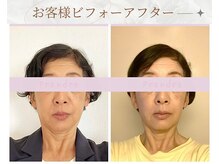 プランドール/フェイスラインがくっきりと☆