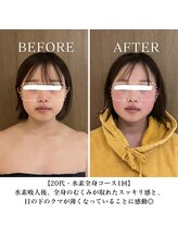 ヨサパーク ココロネ 大倉山(YOSA PARK kokorone)/むくみ、クマとおさらば! /小顔