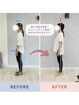 Nピラティス 横浜店/ストレートネックはピラティスで