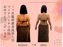 ハニーミー(Honey me)/藝術痩身施術マイナス5キロ♪