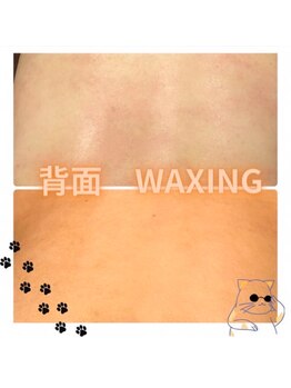 グルーミー(gloomy)/背中ワックス脱毛♪背面美人