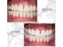 時間旅行/施術前と施術後