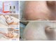 スマイルビューティラボ(Smile Beauty lab.)の写真