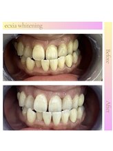 エクシアホワイト 長野店/