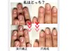 【どのメニューを選べばいいかわからない方】カウンセリング+当日施術体験