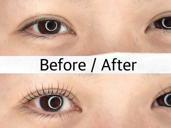 ウポレヘアー(upole hair)