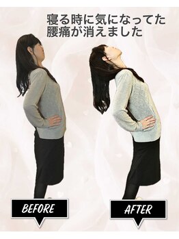 ニコ(nico)の写真/「嘘みたい！5年続いた腰痛が消えてる…」いろいろ通っても、今ひとつ腰痛が良くならずツライあなたへ。