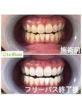 ルブラン 奈良店(Le Blanc)/誰もが憧れる理想の歯に！！