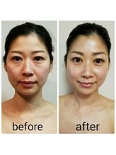 ヘルス＆ビューティークリニック　住美香（すみか）/24金純金パックで小顔＆艶肌に！