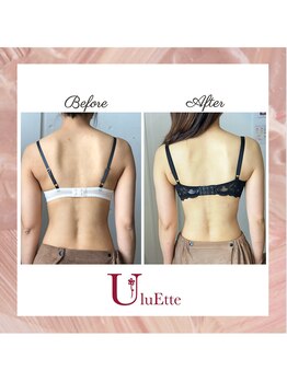 ウルエッテ(UluEtte)/ドレス姿も綺麗に。バストアップ