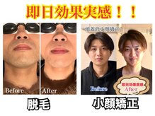 エクシア(ECXIA)の雰囲気（脱毛サロンECXIAへようこそ♪お仕事帰りでも気軽にご来店下さい）