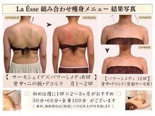 ラエッセ(La Esse)/背中・デコルテ美人