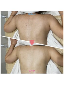 アヴニール 光の森(AVENIR)/ブライダルシェービングコース