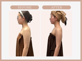 スリムライン 秋田店(The Slim Line)/before→after