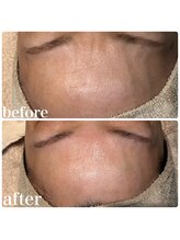 ディオーネ 春日井勝川店(Dione)/マーメイドセルトリートメント