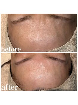 ディオーネ 春日井勝川店(Dione)/マーメイドセルトリートメント