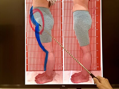 ビジリンヌの写真