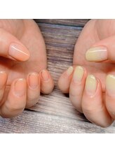 爪屋べっぴん堂/