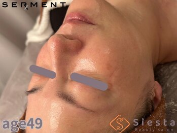 シエスタ(siesta)/セルマン艶珠肌トリートメント