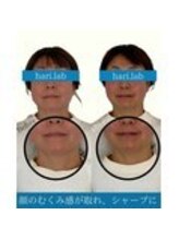 ハリラボ 仙台上杉店(hari Lab.)/【お客様の声】