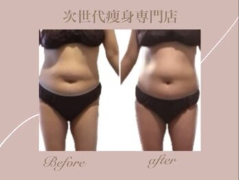 ヨサ パーク モモ(YOSA PARK MOMO)/ぽっこりお腹へのアプローチも◎