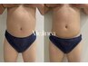 圧倒的ビフォーアフター！最短痩せ1箇所6000円