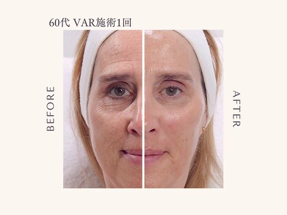 ウーキ(WOOKI)の写真