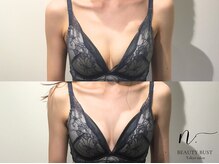 エヌドット 日本橋(N.)/ブライダル前デコルテふっくら♪