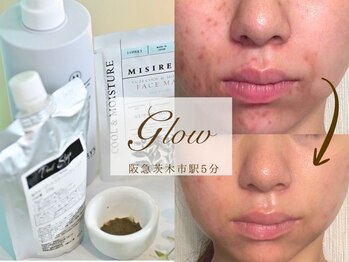 グロウ(glow)/人気NO1メニュー