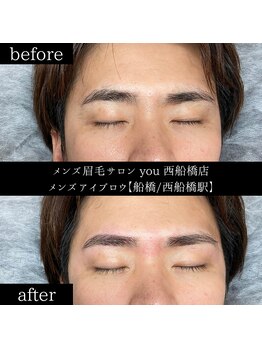 ユー 西船橋店(you)/ビフォーアフター写真