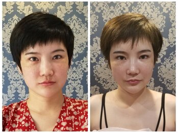 アゴラ/【小顔】【中国での実績もあり】