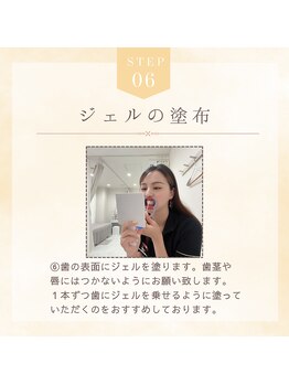 ホワイトニングショップ 奈良香芝店(Whitening shop)/セルフホワイトニング手順6